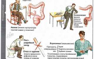 Симптомы интоксикации организма при запоре