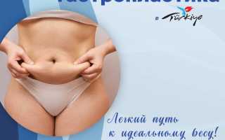 Рукавная гастропластика — новый путь к стройности и здоровью