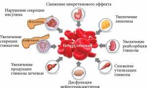 Метформин и Диабетон — В чем разница?
