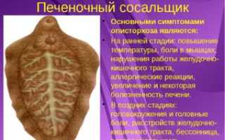 Признаки печеночного сосальщика — как распознать заболевание