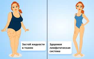 Как распознать начало очищения лимфы
