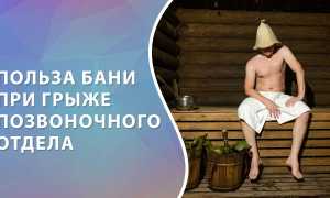 Париться ли в бане с грыжей — мнения врачей и практика