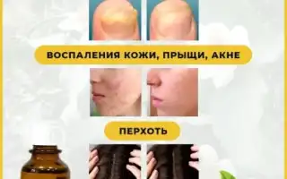 Эфирное масло чайного дерева для ногтей