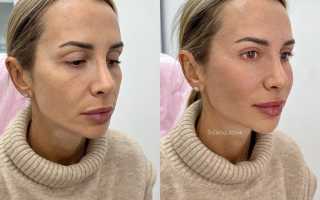 Уход за кожей лица после 30