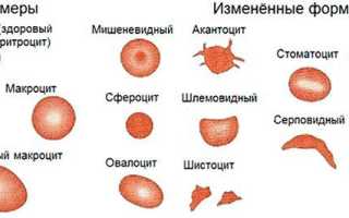 Размер микроцита — что нужно знать