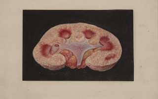 Токсический нефрит