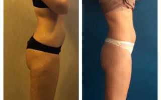 Отзывы и результаты диеты на твороге