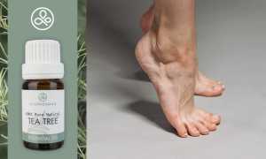 Эффективные народные средства от грибка ногтей на ногах