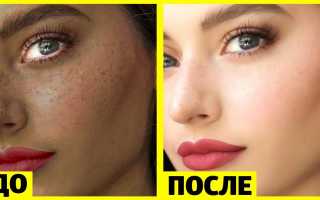 Отбеливание кожи: как можно отбелить кожу лица и чем — средства