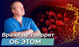 Евдокименко — мифы и правда о холестерине