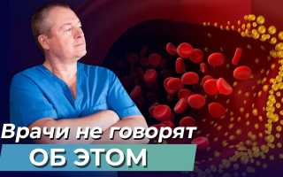 Евдокименко — мифы и правда о холестерине