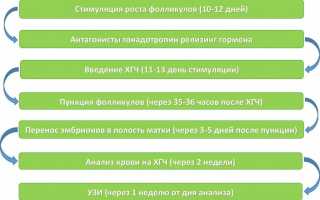 Процедура ЭКО — Что это? — Этапы процедуры — Возможные варианты
